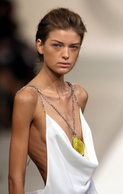 Người mẫu "gầy giơ xương": Cơn ác mộng dai dẳng mà ngành công nghiệp thời trang đã tạo ra!